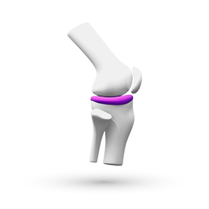 Izmok, csontok és ízületek